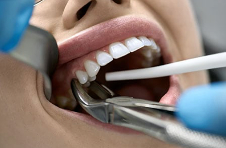 Oral Surgery Treatment